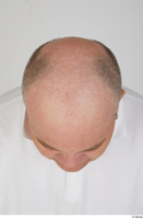  Street  942 bald hair head 0004.jpg